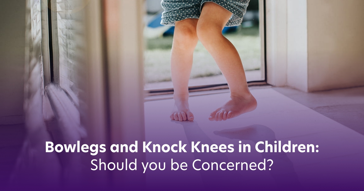 Bowlegs and Knock Knees in Children: Should you be Concerned? 